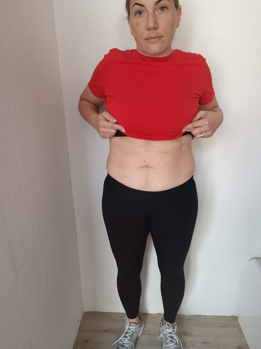 Ana nach der EM-Bodyshaper Behandlung